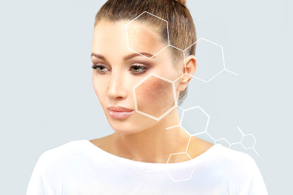 attractive woman with areas of discoloured skin highlighted on cheek and forehead